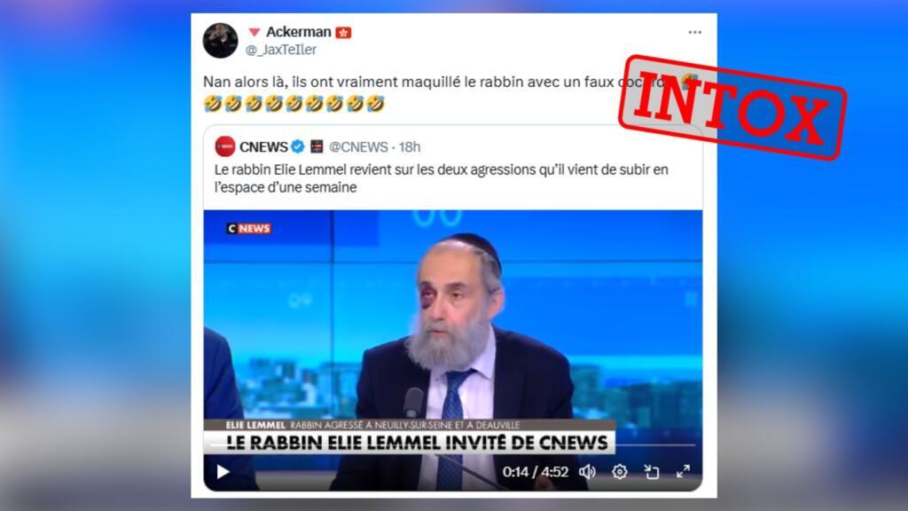 Rabbin agressé à Neuilly-sur-Seine : fausses accusations de mises en scène et vraies blessures